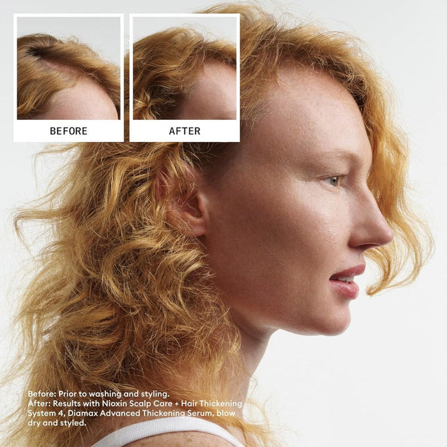 Nioxin System 4 Shampoo - Color Treated With Progressed Thinning